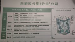 白癜風的分型，分類，分期
